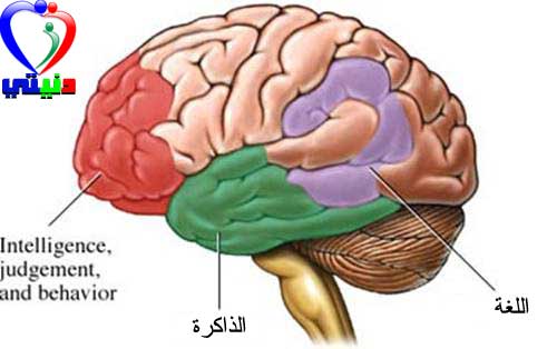 الزهايمر