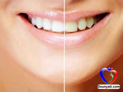 نصائح لحماية الاسنان من الاصفرار