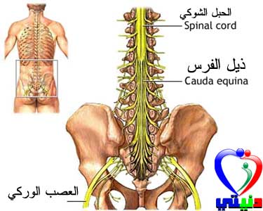 عرق النسا